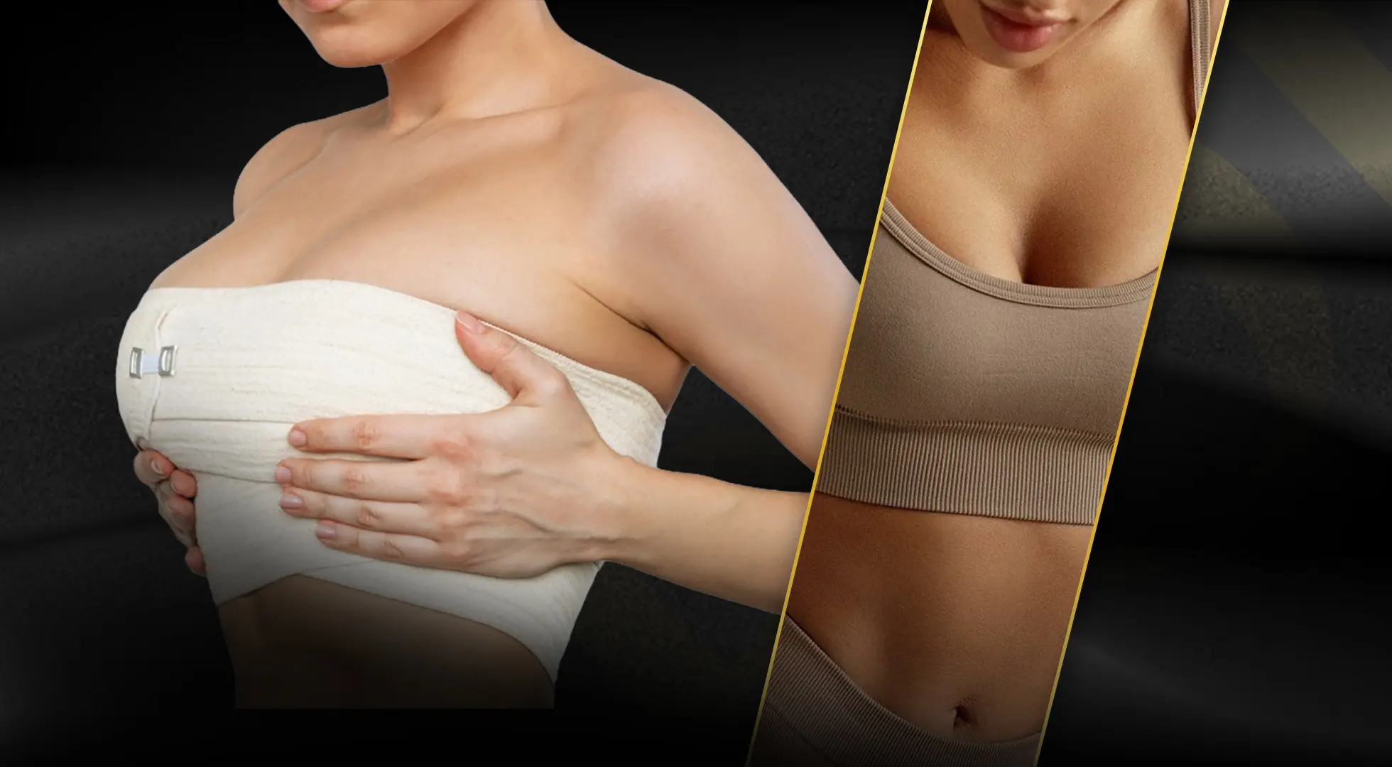 5 Tips for the Best Breast Augmentation Results
