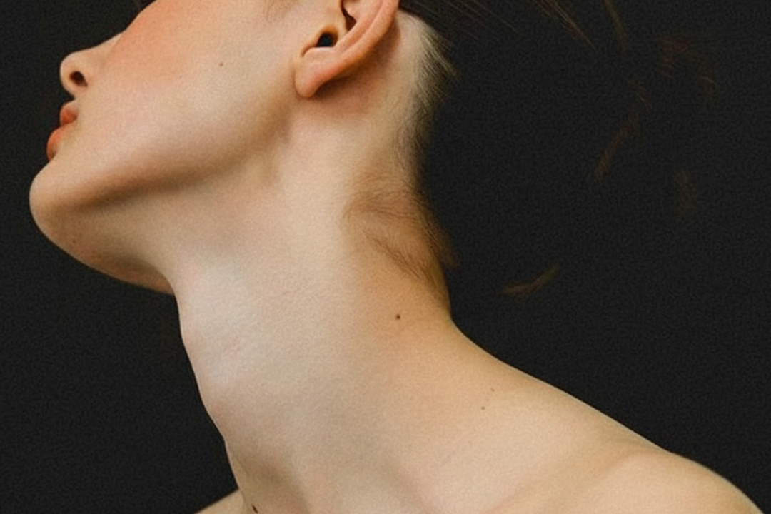 Full Neck Contouring (Liposuction + Lift)