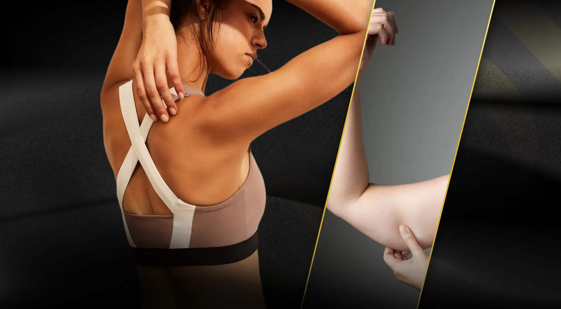 Recovery After Arm Lift: Complete Guide