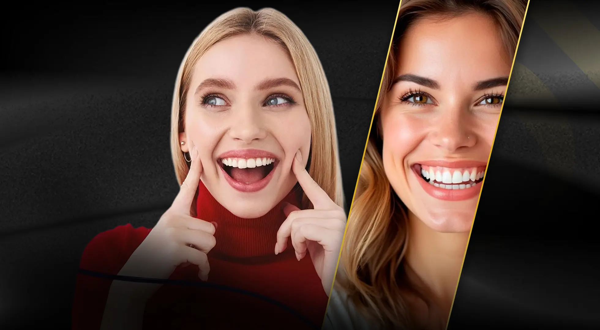 How Long Does a Hollywood Smile Last?