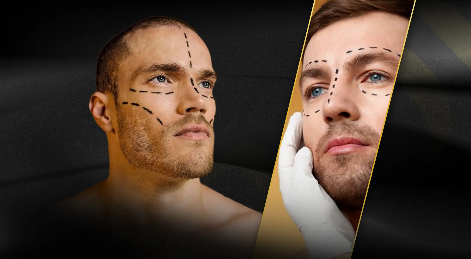 Men's Aesthetic Surgery in Turkey: Complete Guide