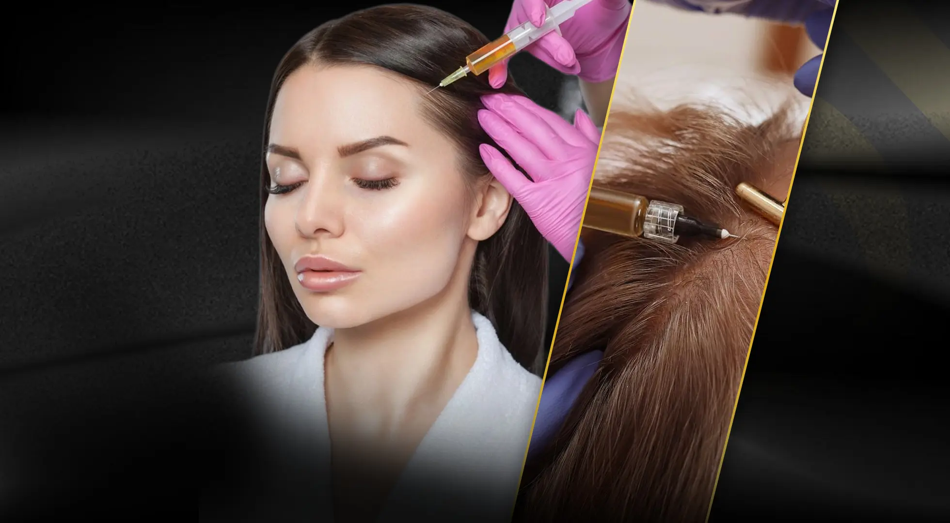 PRP Hair Treatment: What Is It?